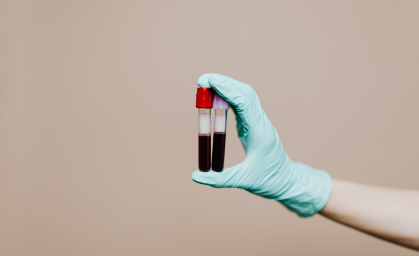 Exame de sangue que detecta mais de 50 tipos de câncer chega ao Brasil